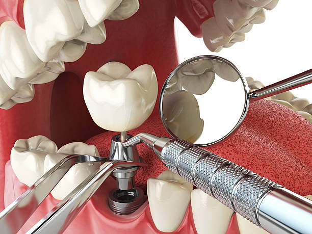Best Emergency Root Canal Therapy in Oxford, NC